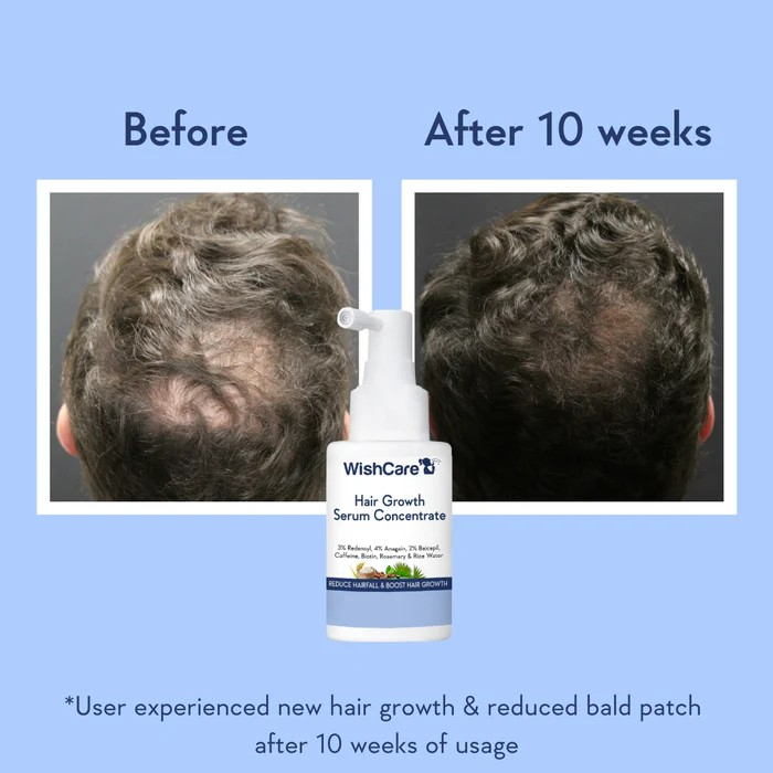 WishCare Hair Growth Serum Concentrate