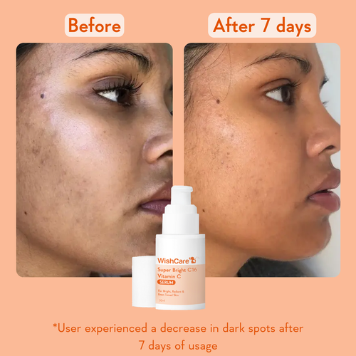 WishCare Super Bright Vitamin C16 Serum