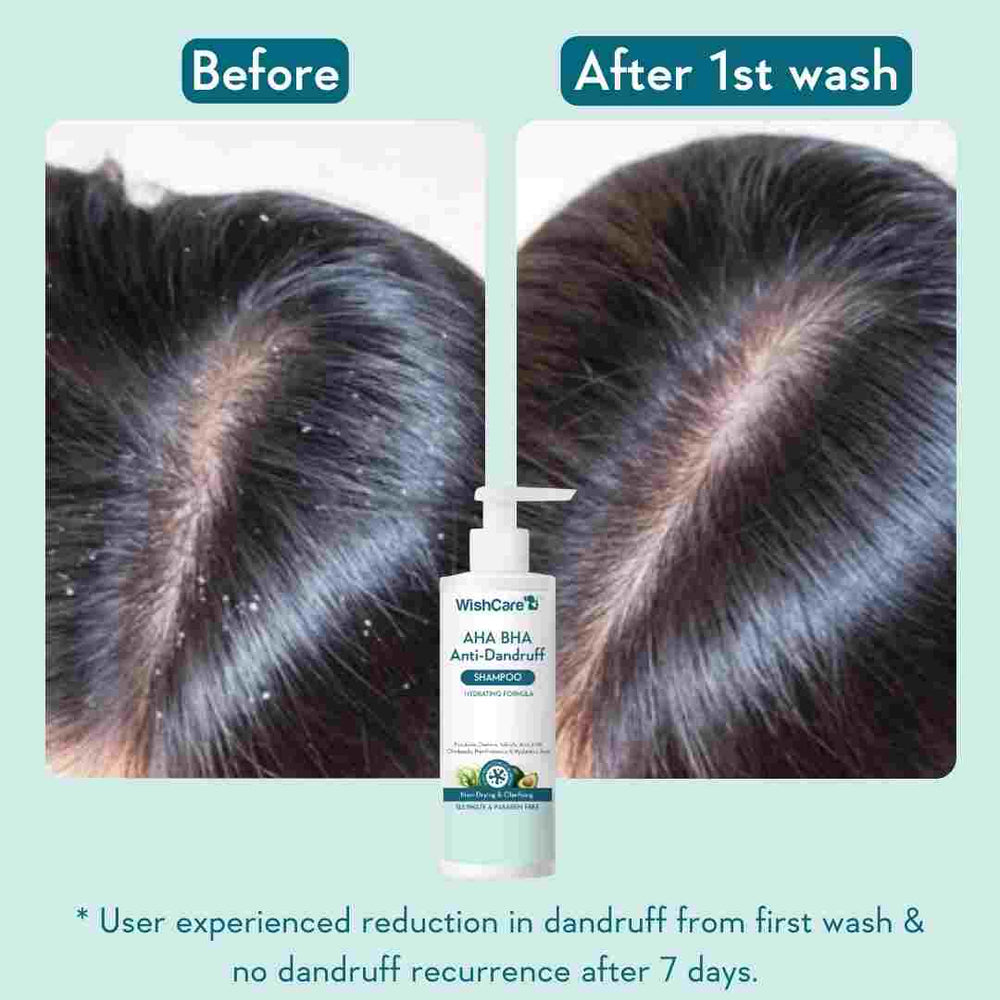 WishCare AHA BHA Anti-Dandruff Shampoo