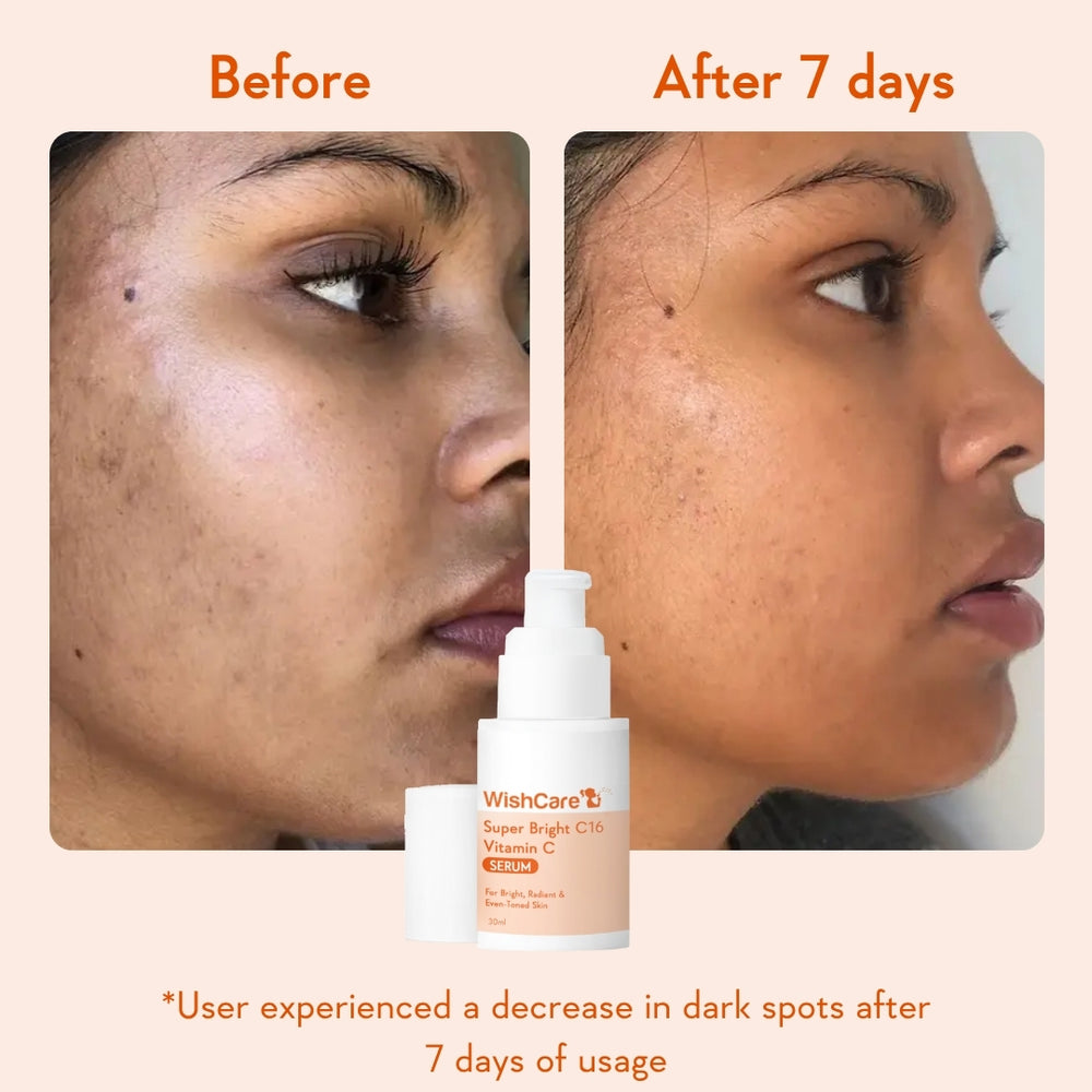 WishCare De-pigmentation Duo