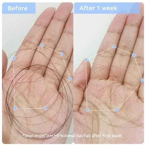 WishCare Hair Growth & Anti Hairfall Duo