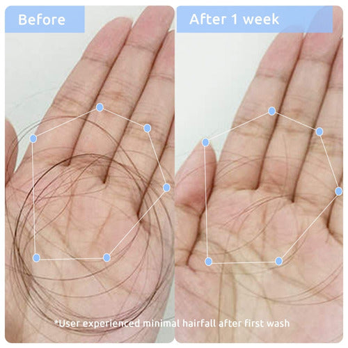 WishCare Multi Peptide Anti Hairfall Duo