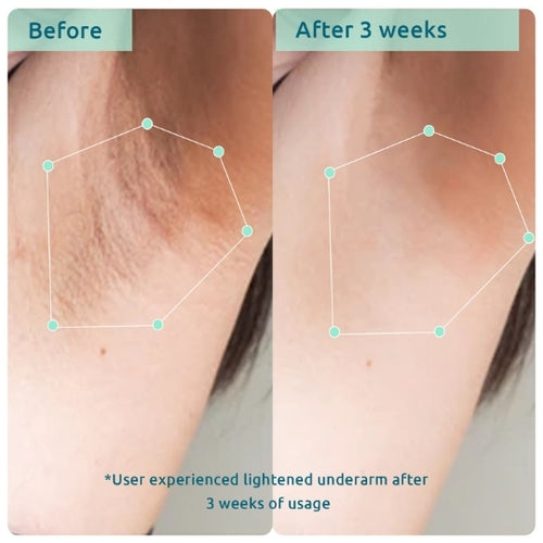 WishCare Bodycare Pigmentation Duo