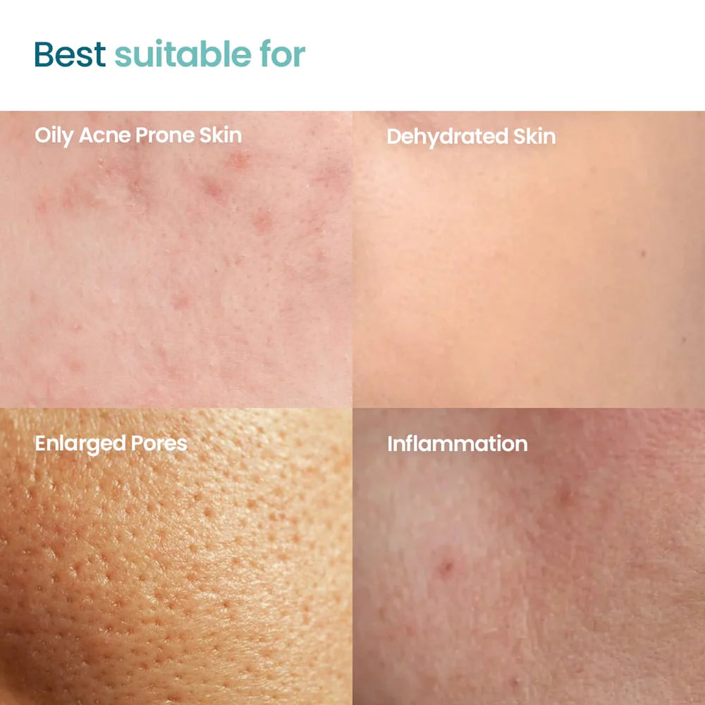 WishCare Acne Essential Trio