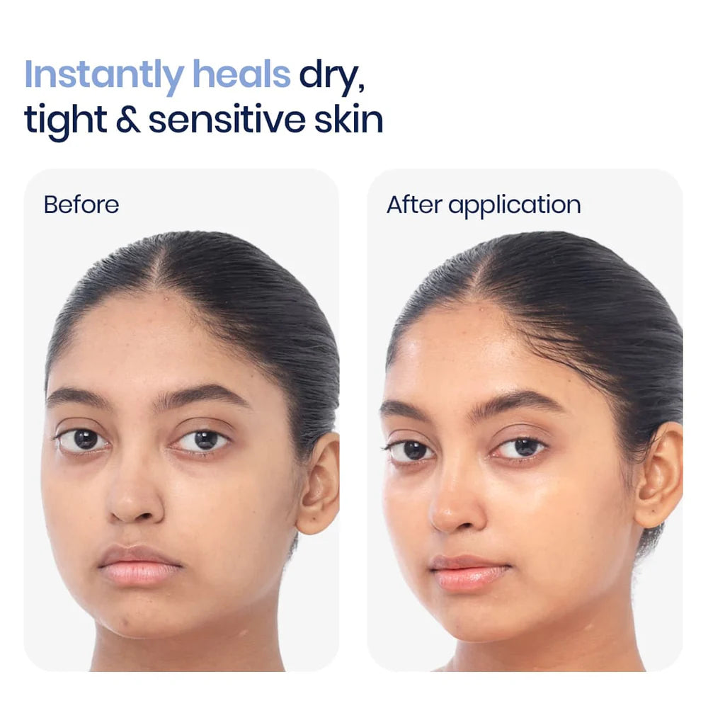 WishCare 3:1:1 Barrier Bounce Moisturizer