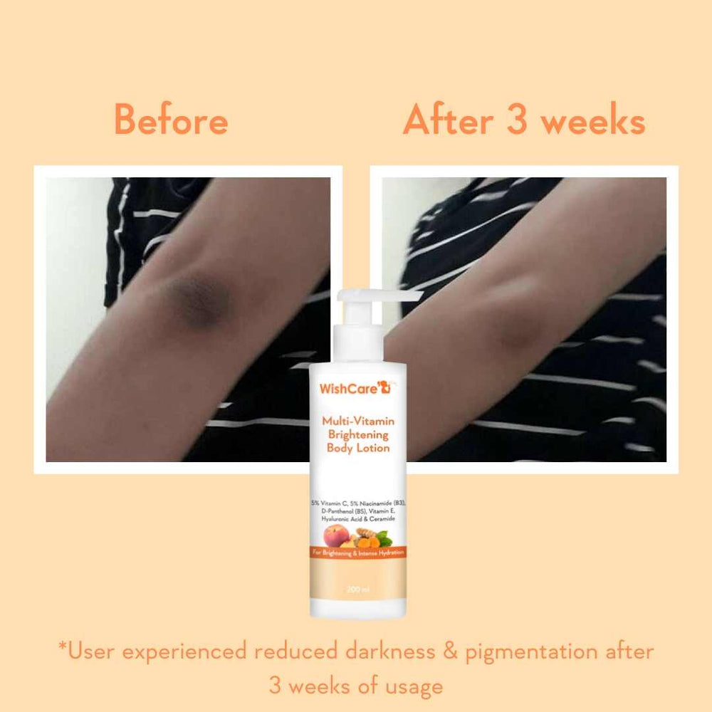 WishCare Multi Vitamin Brightening Body Lotion | 200ml