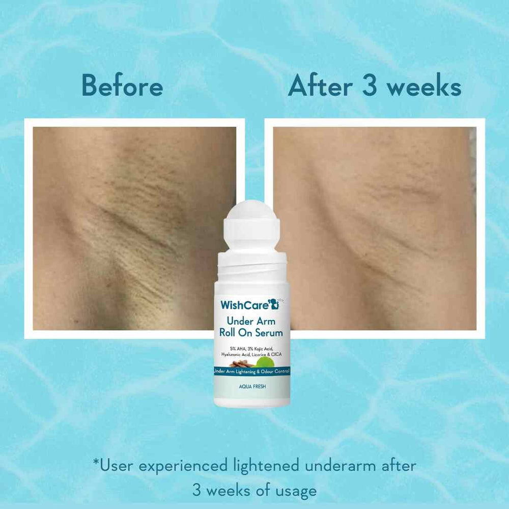 WishCare Under Arm Roll On Serum | 50ml