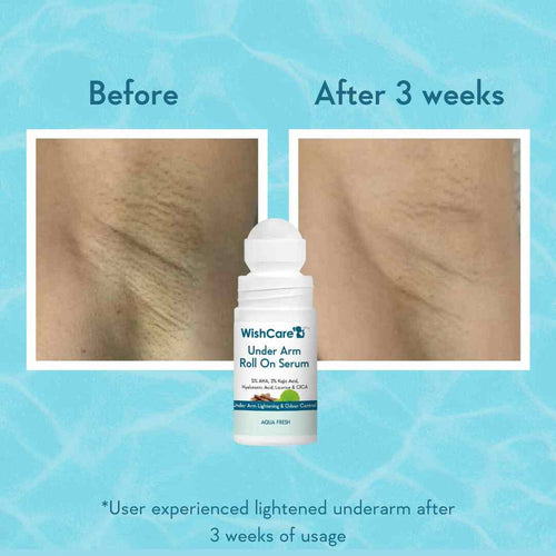 WishCare Under Arm Roll On Serum 50ml