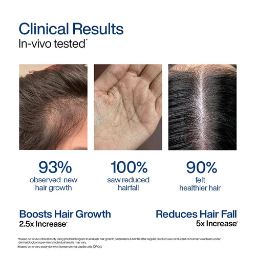 Hair Growth Serum Concentrate Roll-On | 30ml