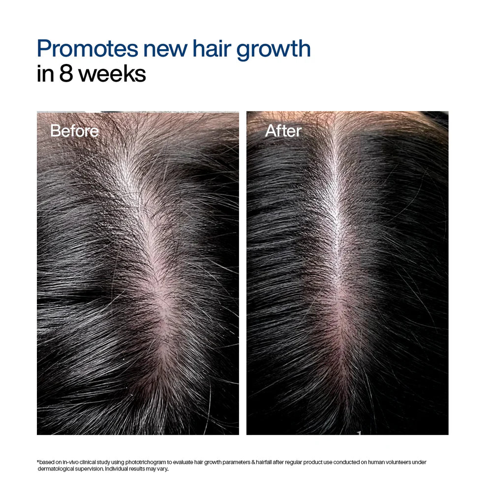 Hair Growth Serum Concentrate Roll-On | 30ml