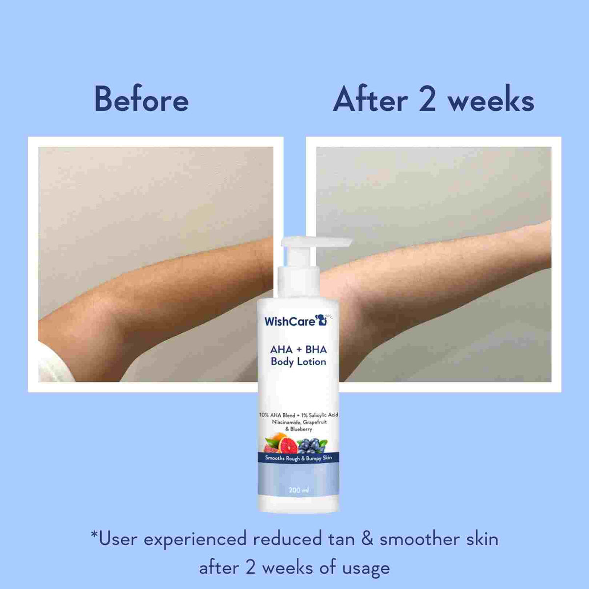 WishCare AHA + BHA Body Lotion | 200ml