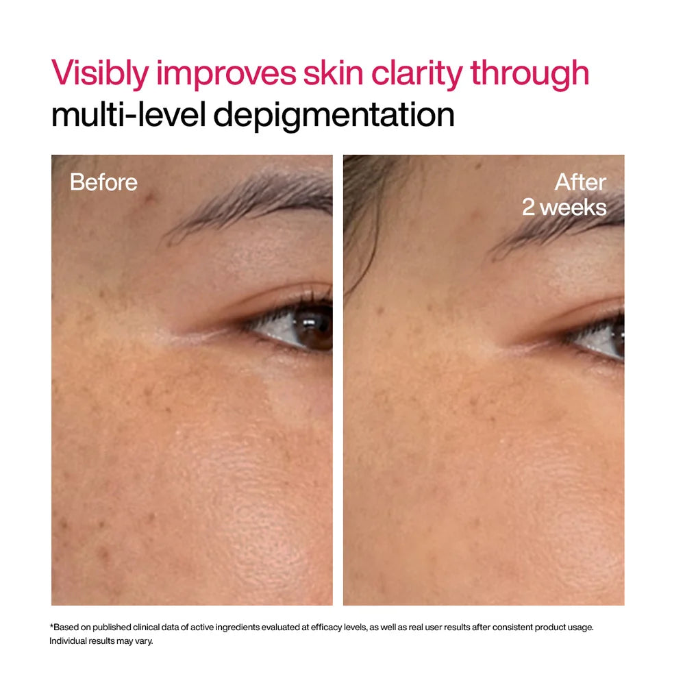 WishCare Advanced Dark Spot Correcting TXA Shot