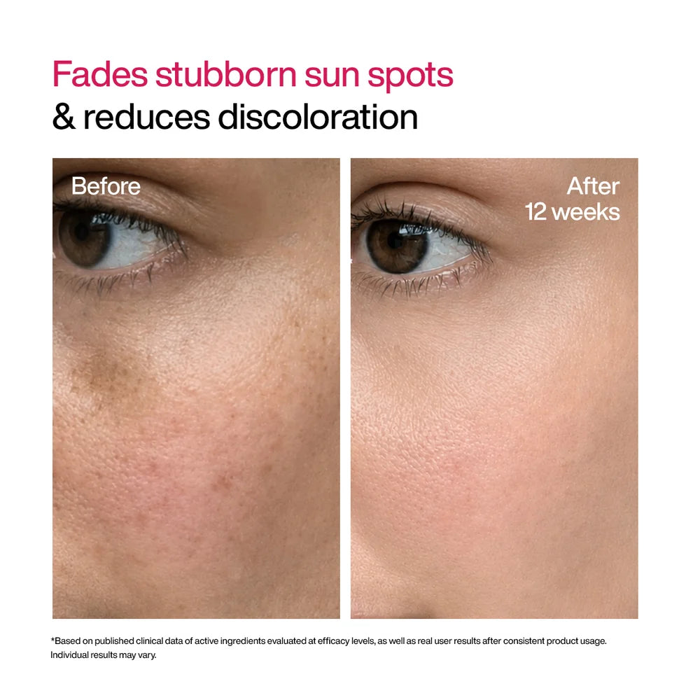 WishCare Advanced Dark Spot Correcting TXA Shot
